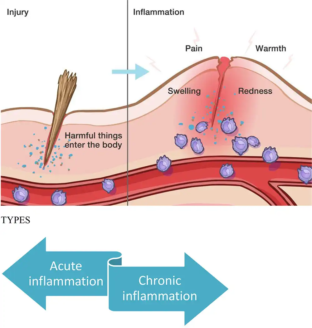 Inflammation in the skin