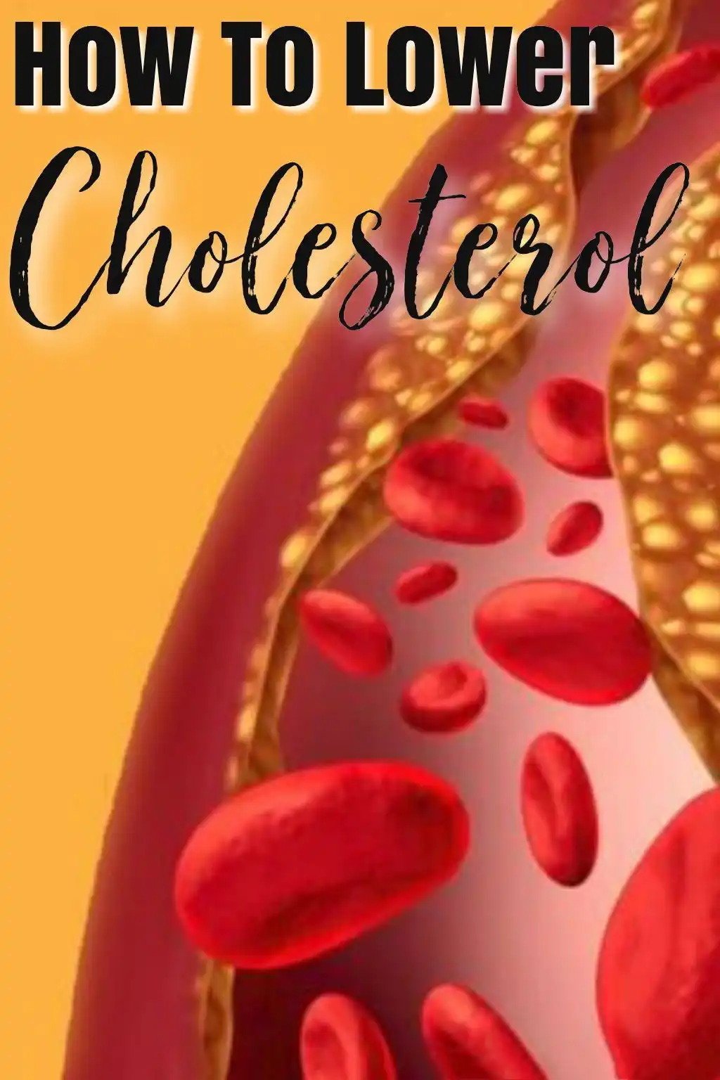 Dihydromyricetin can lower cholesterol levels