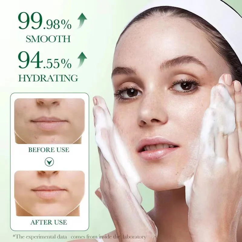 Centella Asiatica Extract can dilute acne marks